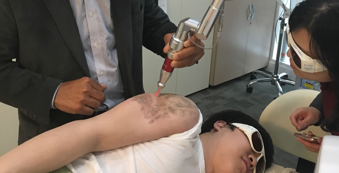 ¿Cuántas sesiones láser necesito para borrar un tatuaje?